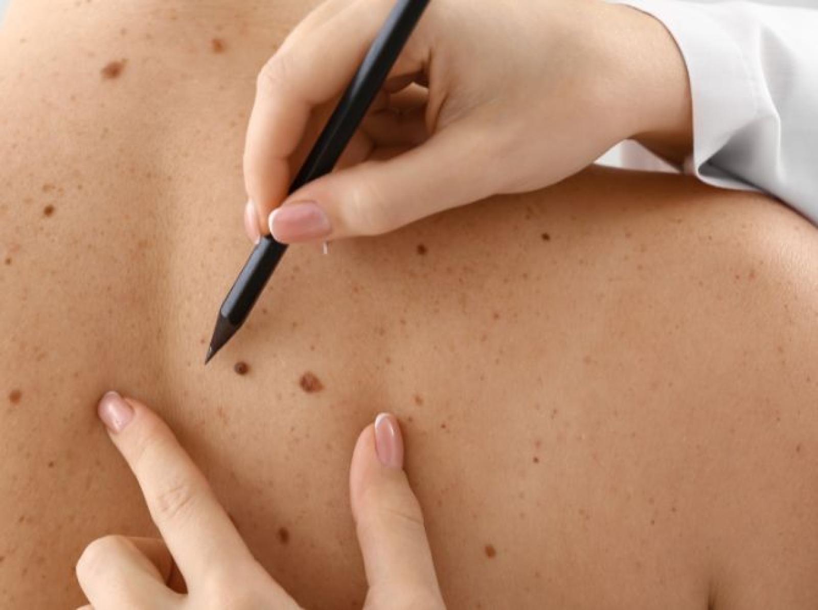 Comprehensive Skin Health Care at The Madison Medical Practice Berowra